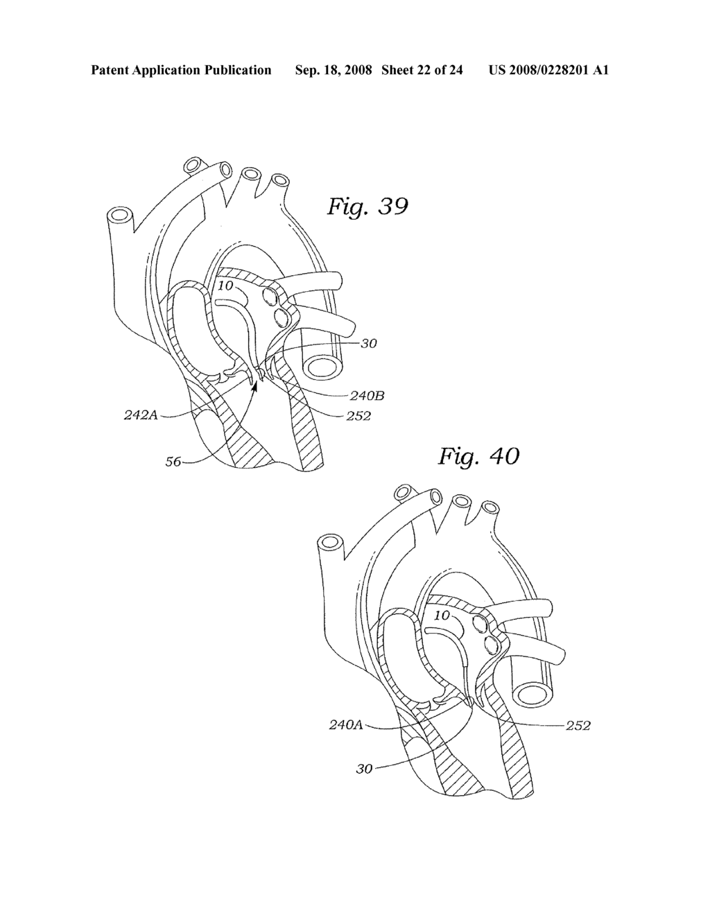 MITRAL VALVE REPAIR SYSTEM AND METHOD FOR USE - diagram, schematic, and image 23