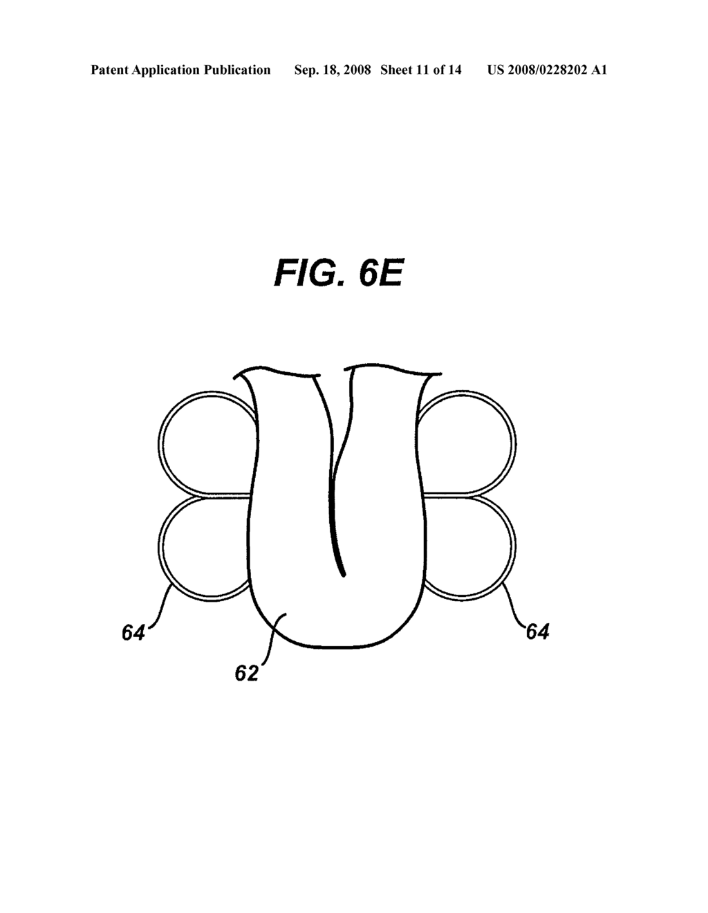 ENDOSCOPIC TISSUE APPROXIMATION SYSTEM - diagram, schematic, and image 12