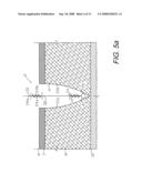 SCREEN DEVICES AND METHODS FOR CLOSING TISSUE SEPARATIONS diagram and image