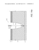 SCREEN DEVICES AND METHODS FOR CLOSING TISSUE SEPARATIONS diagram and image