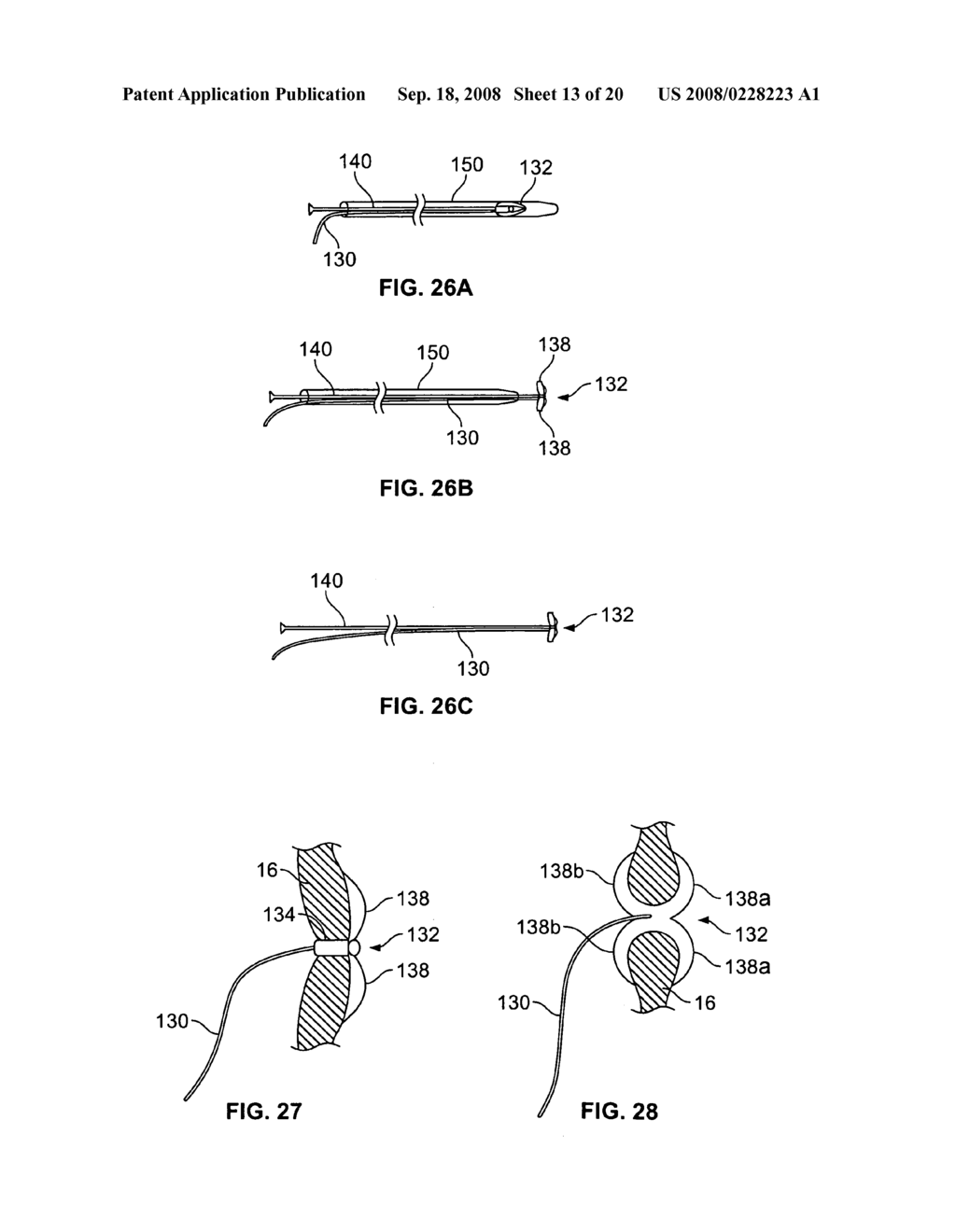 Heart valve chordae replacement methods and apparatus - diagram, schematic, and image 14