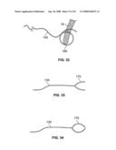 Heart valve chordae replacement methods and apparatus diagram and image