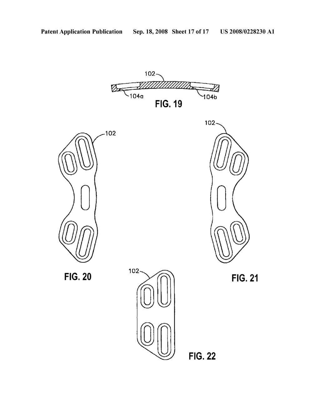 Hinged Bone Plate and Related Methods - diagram, schematic, and image 18