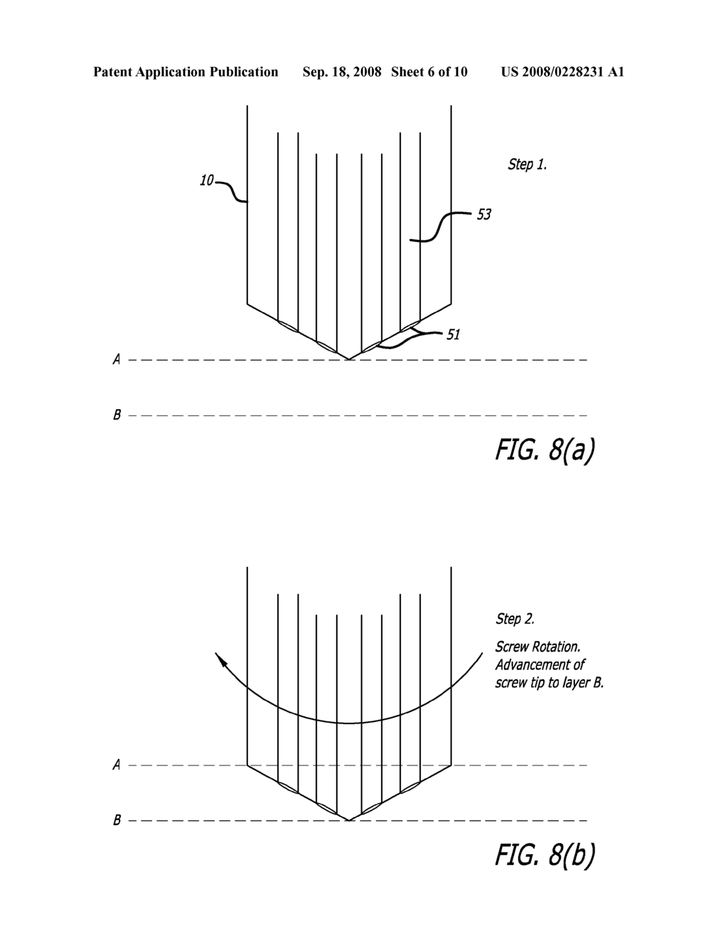 Acoustic Back-Scattering Sensing Screw for Preventing Spine Surgery Complications - diagram, schematic, and image 07