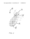 METHODS AND APPARATUS FOR IMPROVED IPG RATE RESPONSE USING SUBCUTANEOUS ELECTRODES DIRECTLY COUPLED TO AN IMPLANTABLE MEDICAL DEVICE (IMD) diagram and image