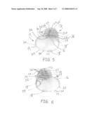 METHODS AND APPARATUS FOR IMPROVED IPG RATE RESPONSE USING SUBCUTANEOUS ELECTRODES DIRECTLY COUPLED TO AN IMPLANTABLE MEDICAL DEVICE (IMD) diagram and image