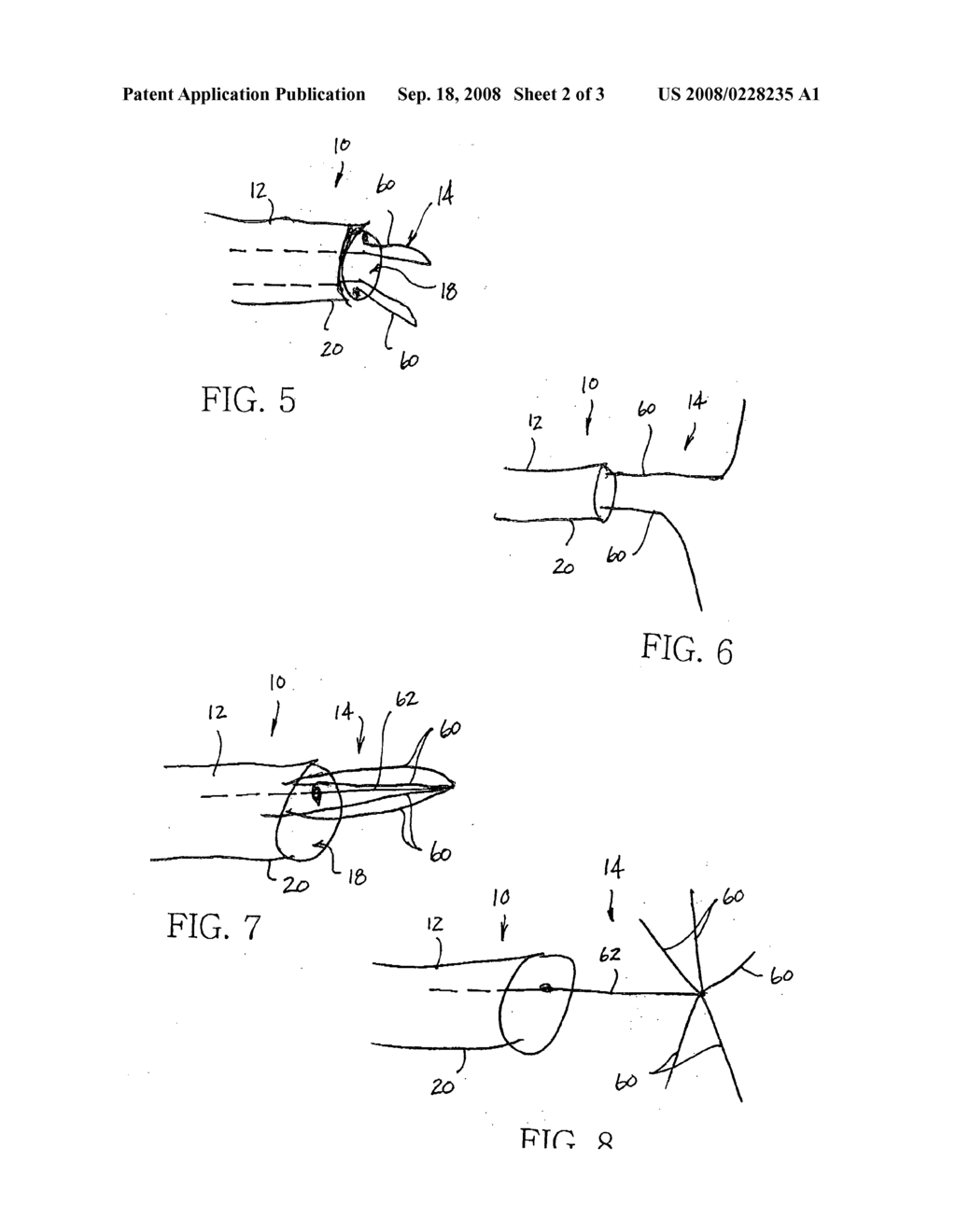 Device and method for fixing an electrical lead - diagram, schematic, and image 03