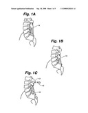 Muscle stimulator diagram and image