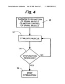 Muscle stimulator diagram and image