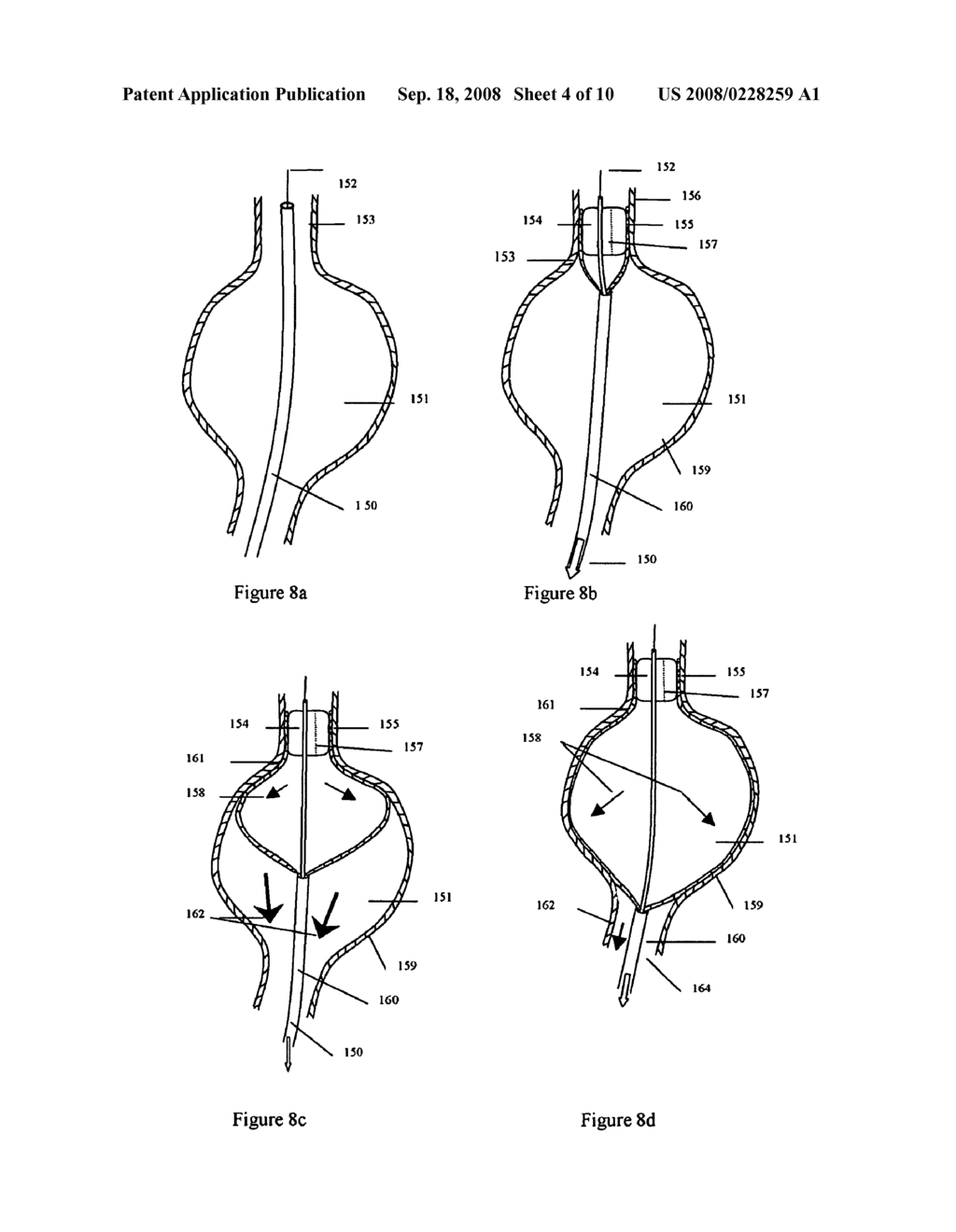 ENDOVASCULAR DEVICES AND METHODS TO PROTECT ANEURYSMAL WALL - diagram, schematic, and image 05