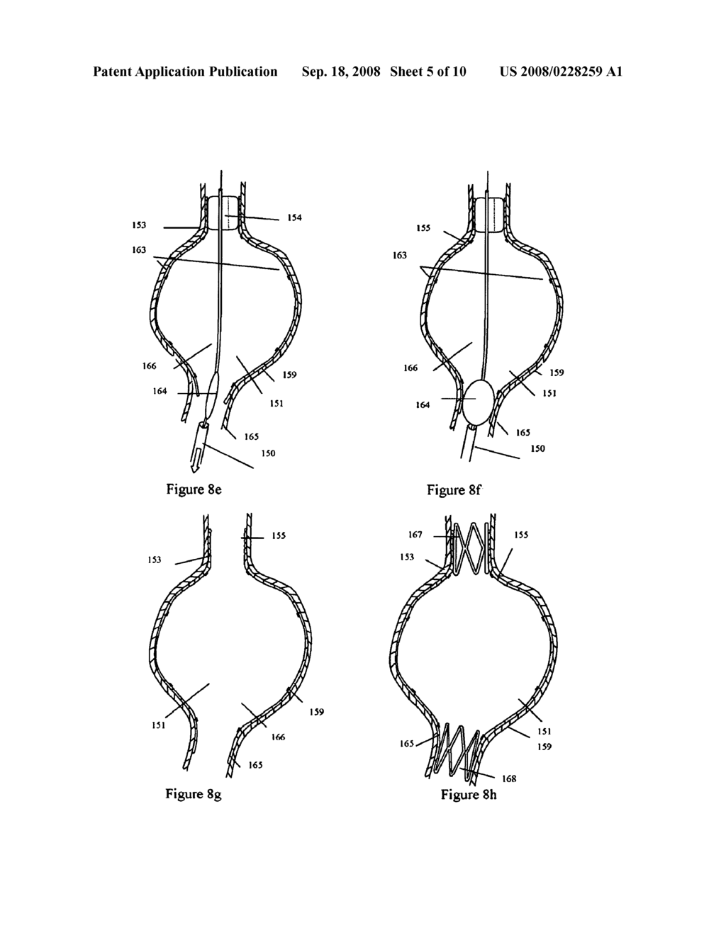 ENDOVASCULAR DEVICES AND METHODS TO PROTECT ANEURYSMAL WALL - diagram, schematic, and image 06