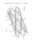 Intravascular stent with integrated link and ring strut diagram and image