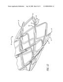 Intravascular stent with integrated link and ring strut diagram and image