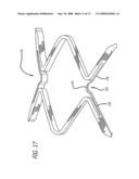 Intravascular stent with integrated link and ring strut diagram and image