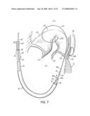 DEVICES AND METHODS FOR INTRODUCING ELEMENTS INTO TISSUE diagram and image