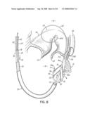 DEVICES AND METHODS FOR INTRODUCING ELEMENTS INTO TISSUE diagram and image