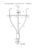 DEVICES AND METHODS FOR INTRODUCING ELEMENTS INTO TISSUE diagram and image