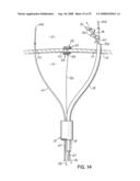 DEVICES AND METHODS FOR INTRODUCING ELEMENTS INTO TISSUE diagram and image