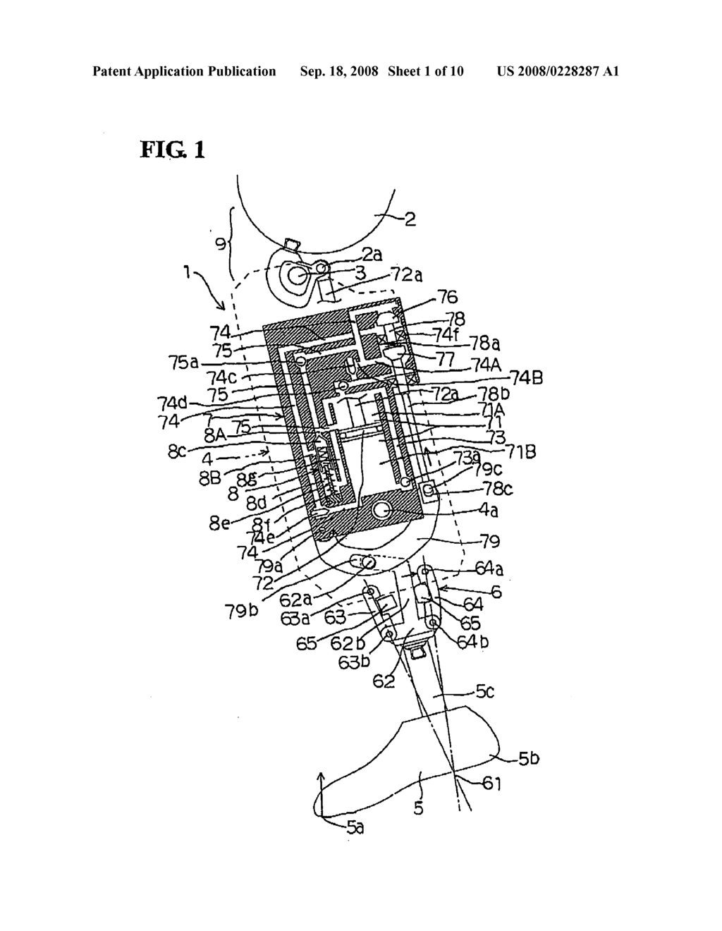 Prosthetic leg - diagram, schematic, and image 02