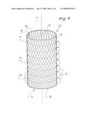 SECURING RING AND CORRESPONDING MANUFACTURING PROCESS diagram and image