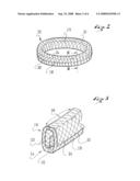 SECURING RING AND CORRESPONDING MANUFACTURING PROCESS diagram and image