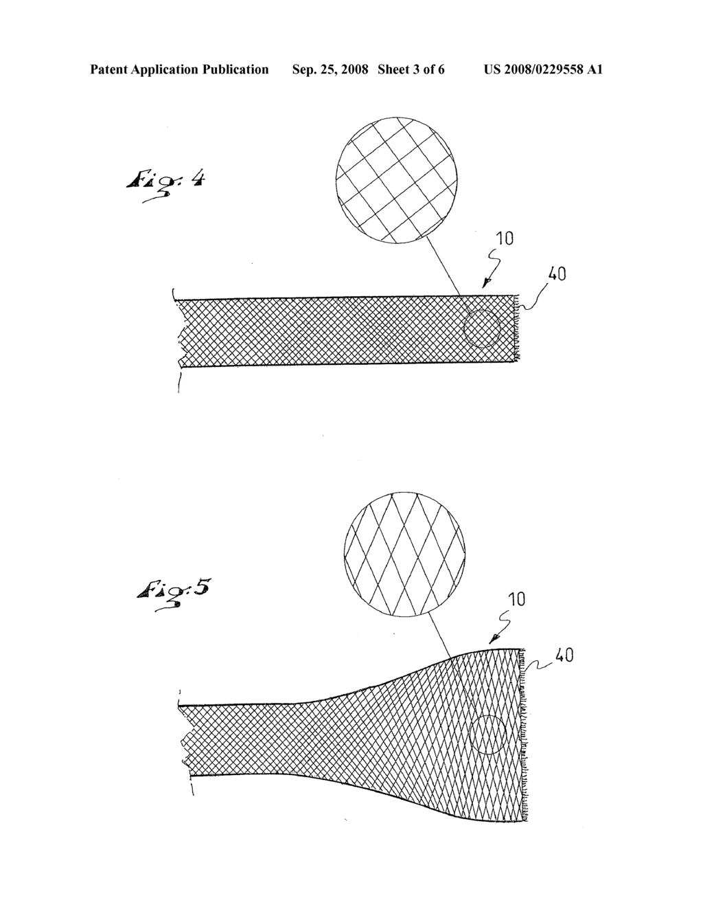 SECURING RING AND CORRESPONDING MANUFACTURING PROCESS - diagram, schematic, and image 04