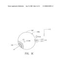 Eye module diagram and image