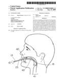 Intubation guide diagram and image