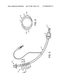 Endotracheal Tube with Radiopaque Distal End Marker diagram and image