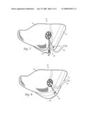 Naso-gastric mask and method diagram and image