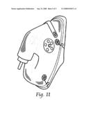 Naso-gastric mask and method diagram and image