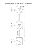 ELECTRONIC ENDOSCOPE APPARATUS diagram and image