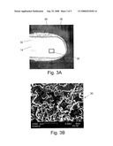 Method For Electrophoretic Deposition Of Conductive Polymer Into Porous Solid Anodes For Electrolyte Capacitor diagram and image