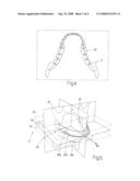 METHOD FOR THE RECONSTRUCTION OF A PANORAMIC IMAGE OF AN OBJECT, AND A COMPUTED TOMOGRAPHY SCANNER IMPLEMENTING SAID METHOD diagram and image