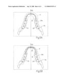 METHOD FOR THE RECONSTRUCTION OF A PANORAMIC IMAGE OF AN OBJECT, AND A COMPUTED TOMOGRAPHY SCANNER IMPLEMENTING SAID METHOD diagram and image