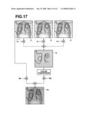 DEVICE, METHOD AND RECORDING MEDIUM CONTAINING PROGRAM FOR SEPARATING IMAGE COMPONENT diagram and image