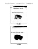 Diagnostic and therapeutic optical agents diagram and image