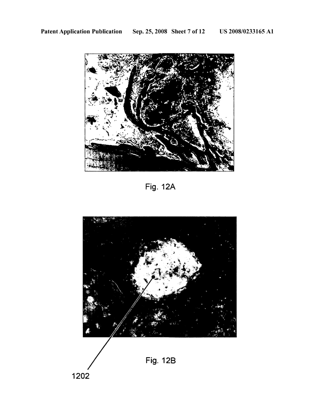 Time release calcium sulfate and growth factor matrix for bone augmentation - diagram, schematic, and image 08