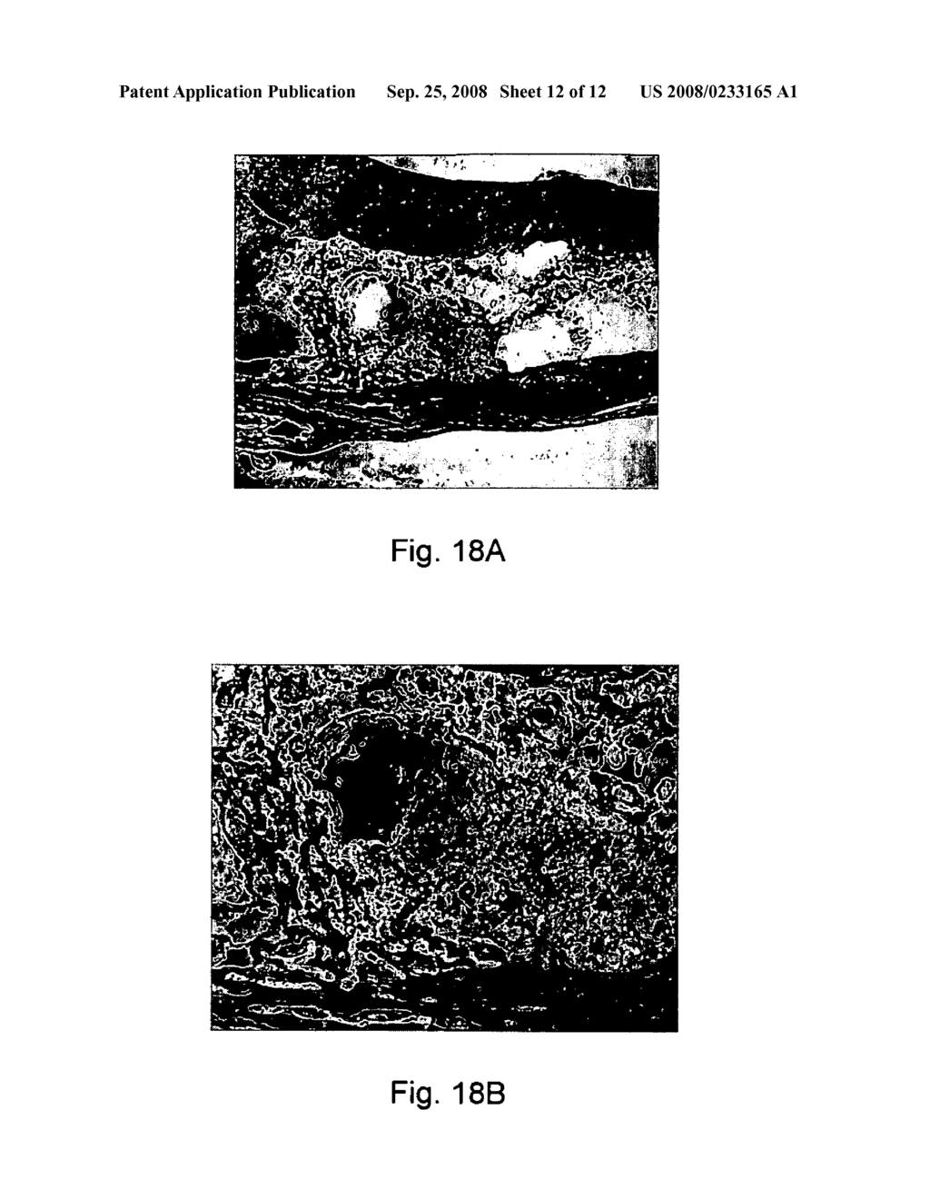 Time release calcium sulfate and growth factor matrix for bone augmentation - diagram, schematic, and image 13