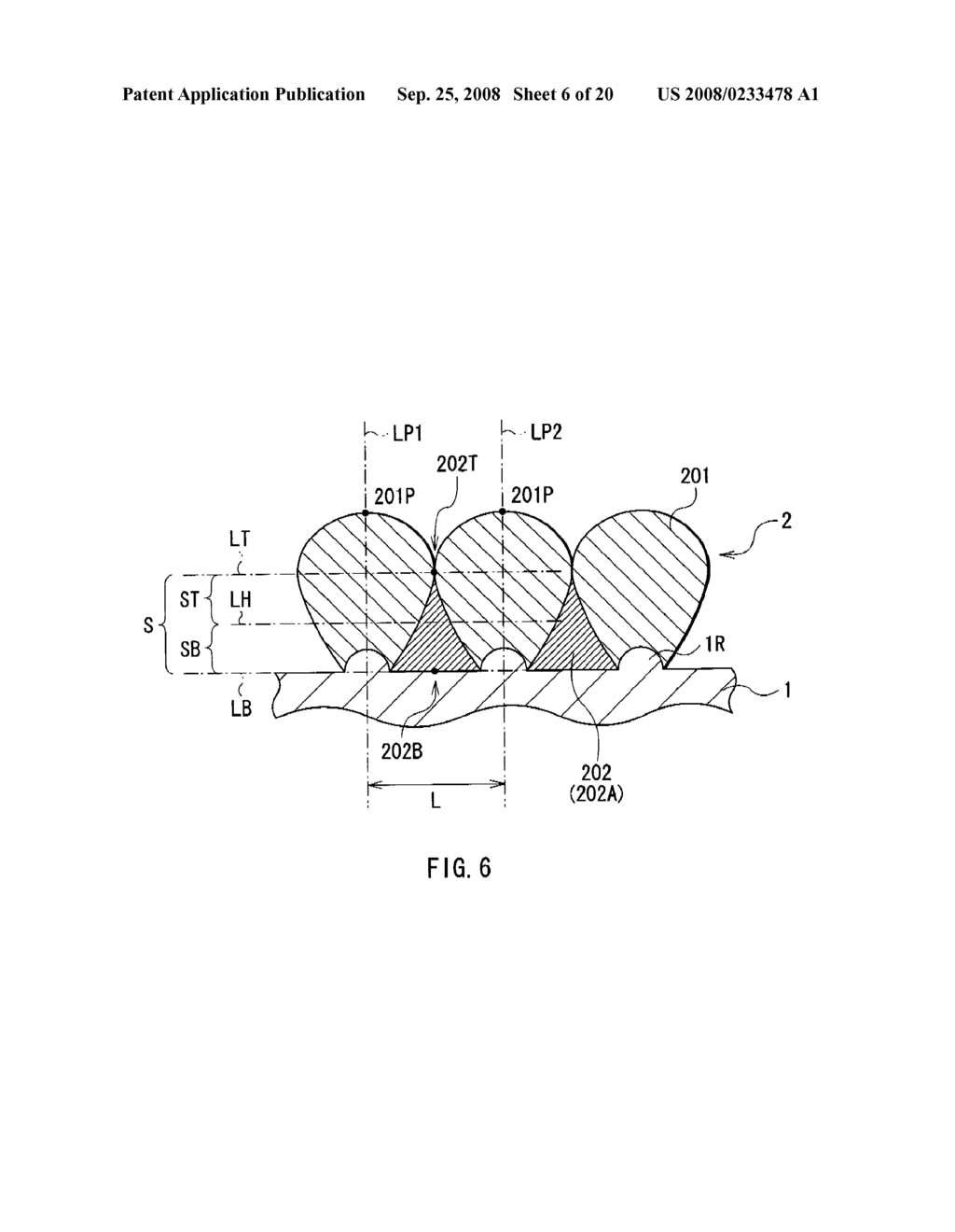 ANODE, METHOD OF MANUFACTURING IT, BATTERY, AND METHOD OF MANUFACTURING IT - diagram, schematic, and image 07