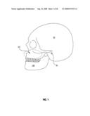 Active attachments for interacting with a polymeric shell dental appliance diagram and image