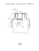 Active attachments for interacting with a polymeric shell dental appliance diagram and image