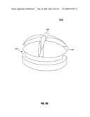 Active attachments for interacting with a polymeric shell dental appliance diagram and image