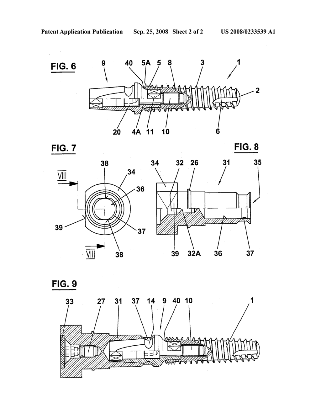 Abutment For a Tooth Implant - diagram, schematic, and image 03