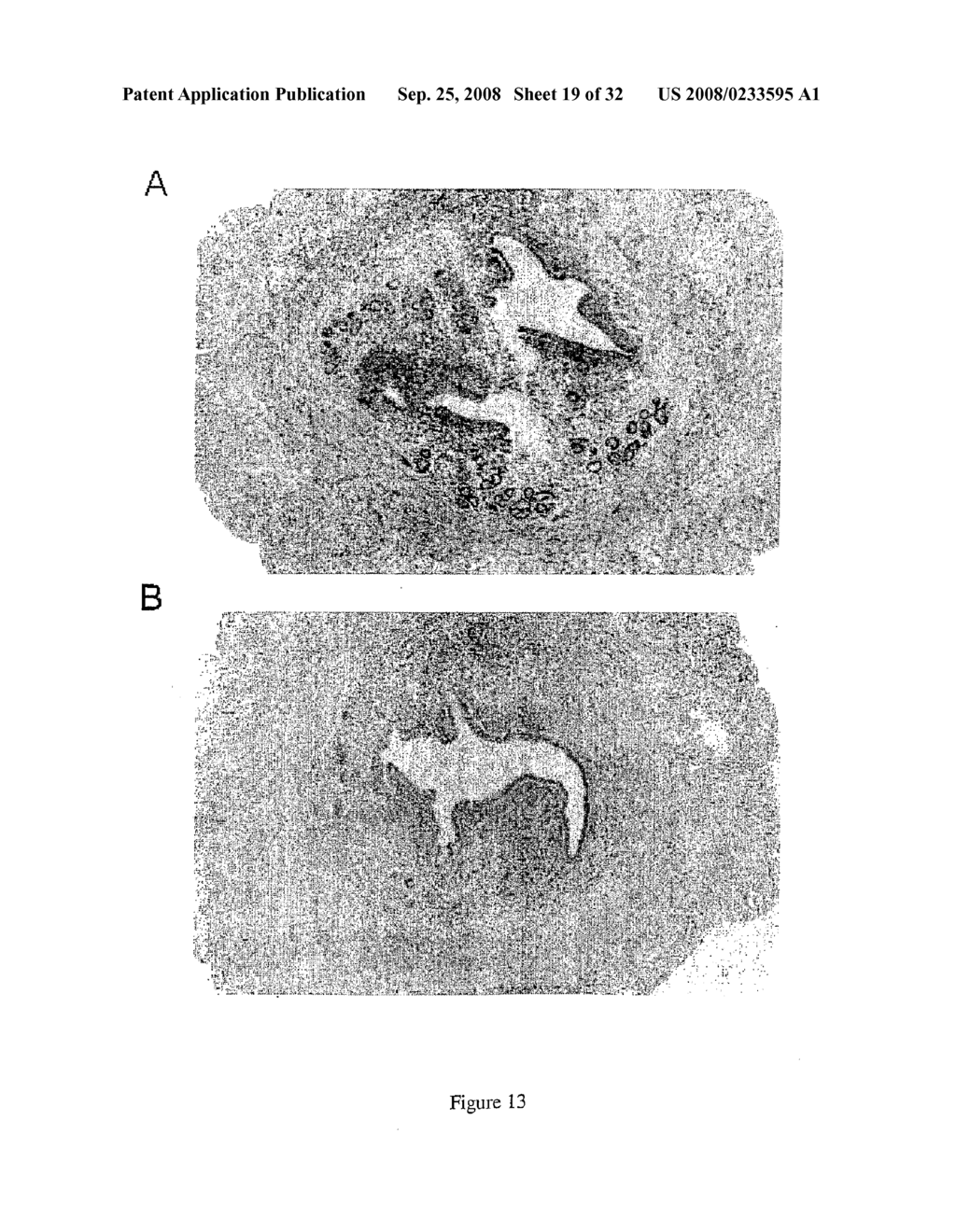 METHOD FOR DIAGNOSING INTERTILITY - diagram, schematic, and image 20