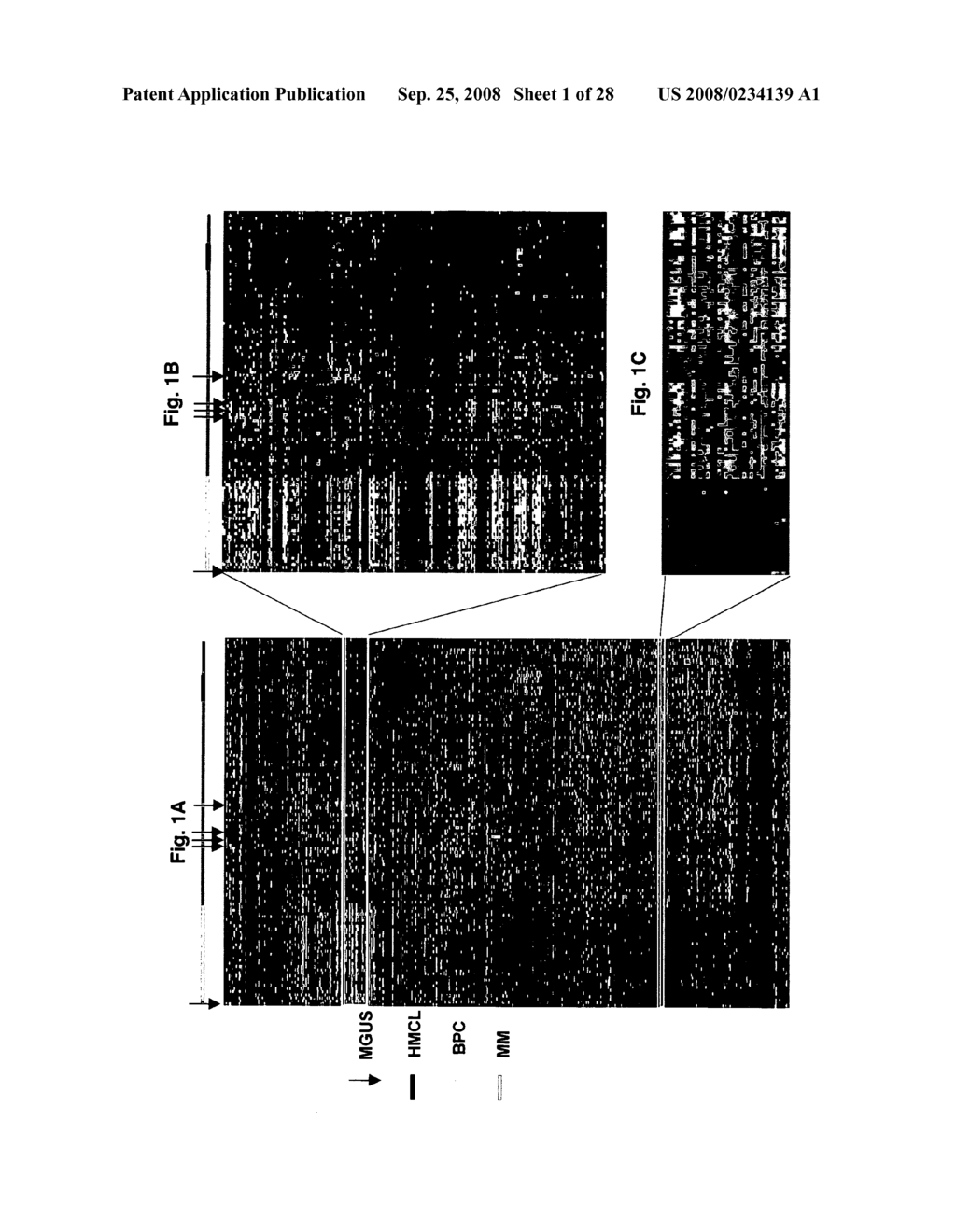 Diagnosis, prognosis and identification of potential therapeutic targets of multiple myeloma based on gene expression profiling - diagram, schematic, and image 02