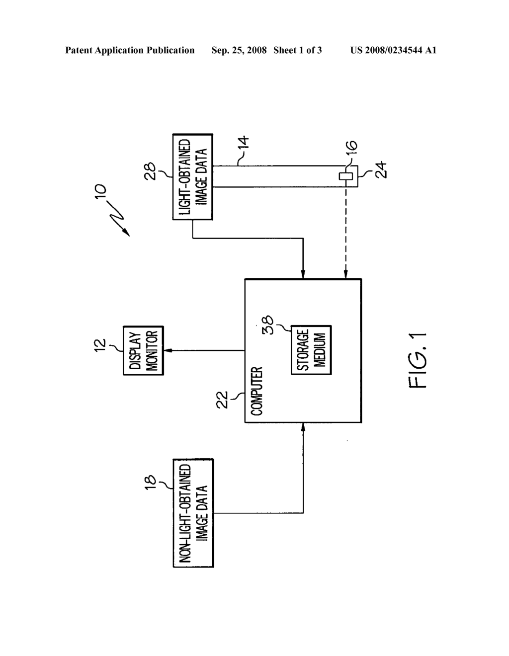 Displaying images interior and exterior to a body lumen of a patient - diagram, schematic, and image 02