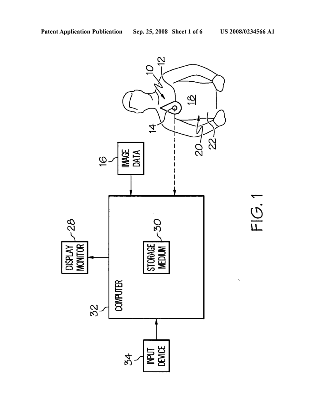 Recognizing a real world fiducial in a patient image data - diagram, schematic, and image 02