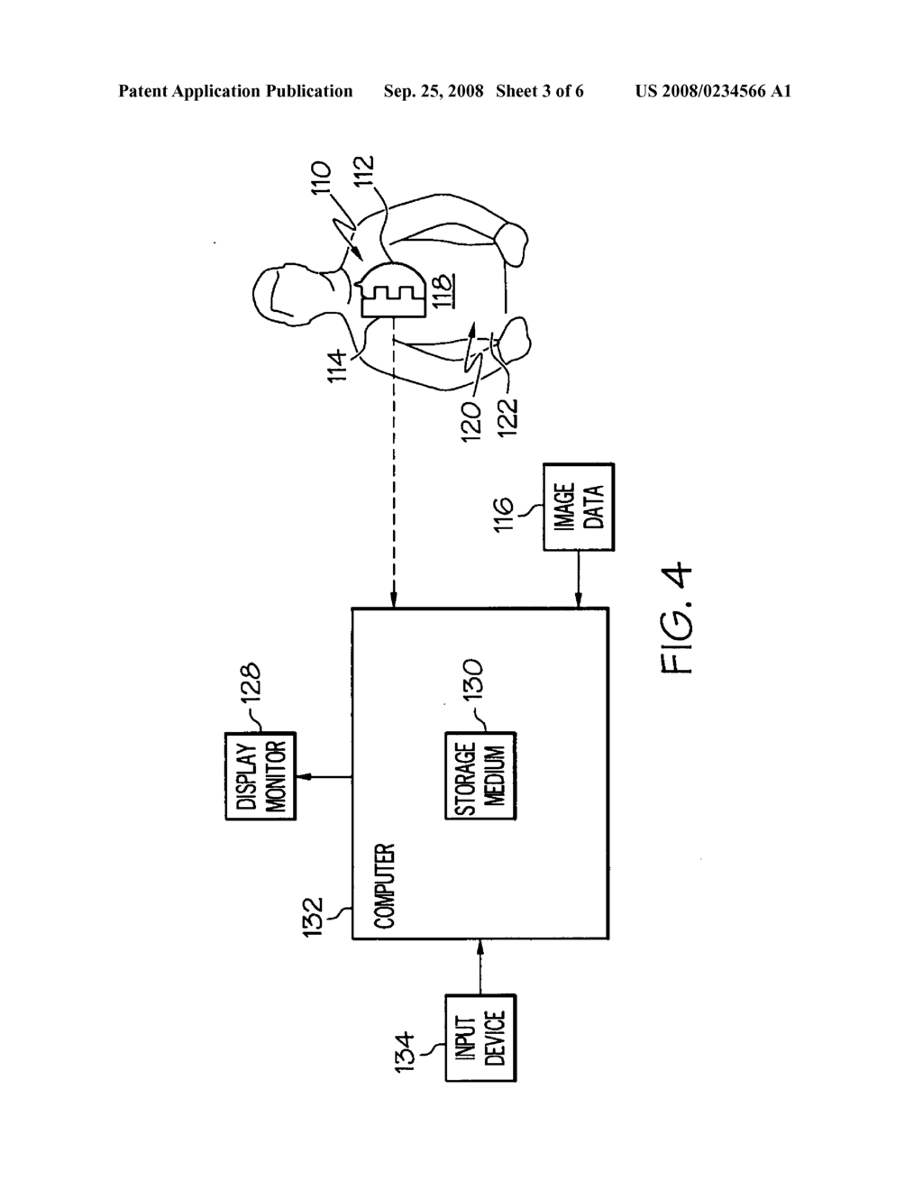 Recognizing a real world fiducial in a patient image data - diagram, schematic, and image 04