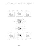 Mri Probe for Prostate Imaging diagram and image